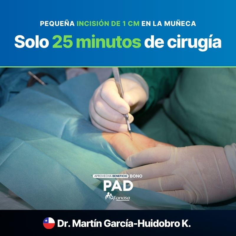 Cirugía túnel carpiano por el Dr. Martín García-Huidobro K. Cirugía túnel carpiano