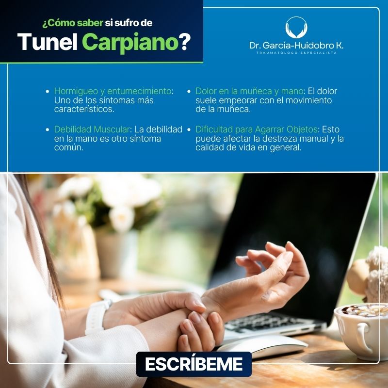 Síntomas síndrome de túnel carpiano Síntomas síndrome de túnel carpiano