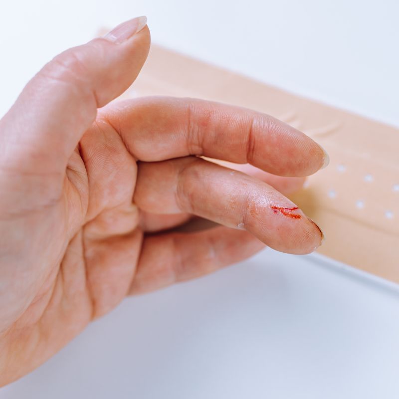 Cirugía dedo en gatillo - Martín García - Huidobro K.